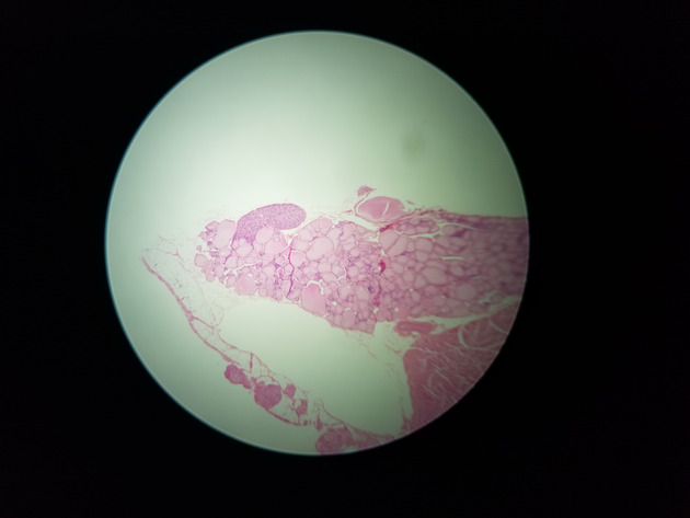 Parathyroid Thyroid Slides - Parathyroid_Thyroid 003 40X